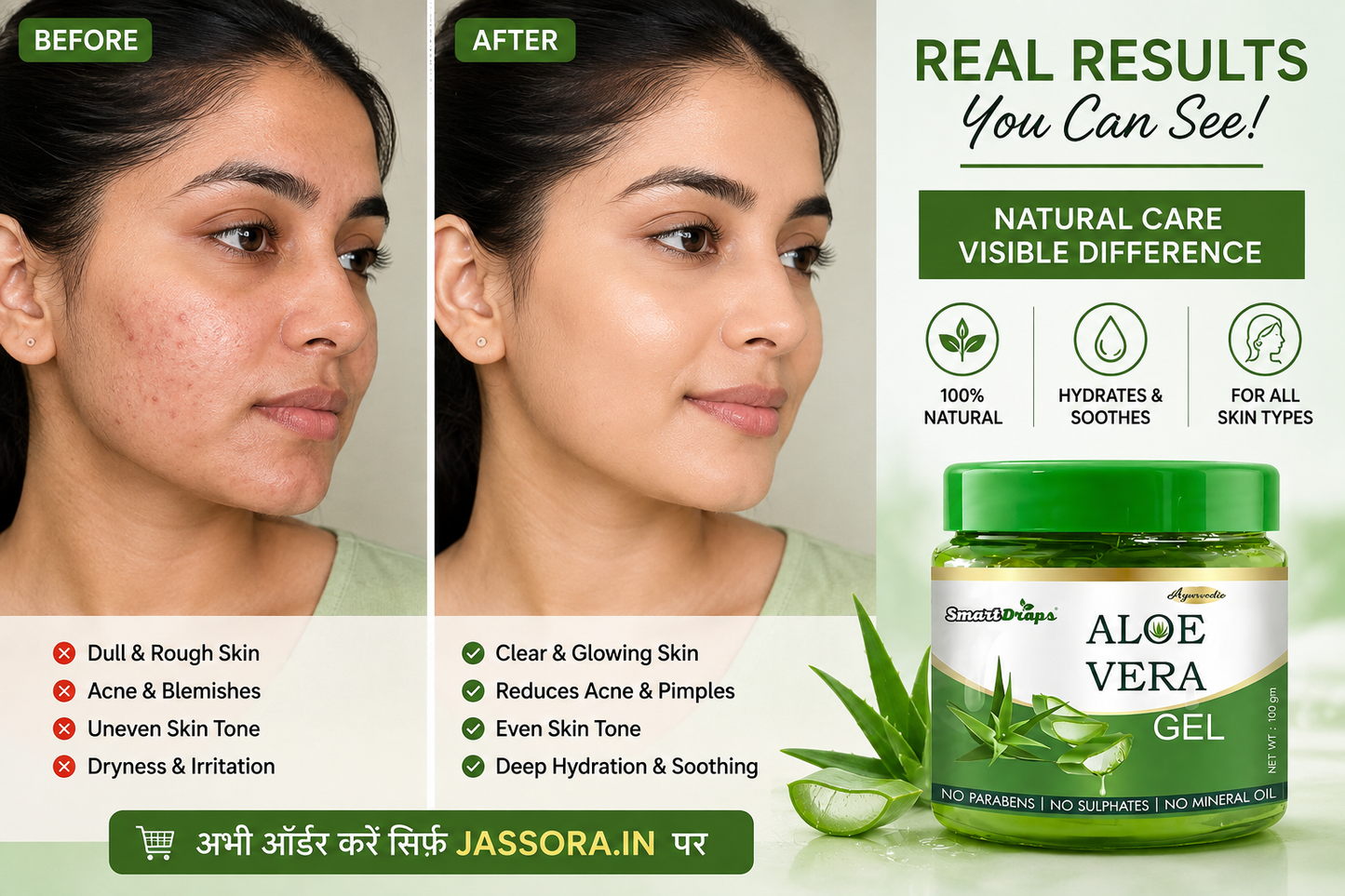 SmartDrops Aloe Vera Gel for Face, Skin & Hair | 100% Natural Hydrating & Soothing Gel | Reduces Acne, Pimples & Dryness | Moisturizing Daily Skin Care Gel | 100g